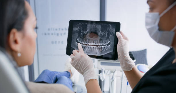 Licensed Tooth Extraction service in Syracuse, UT - Smile Center Dentistry